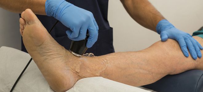 как лечить ревматоидный артрит как лечить ревматоидный артрит