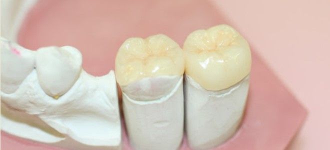 керамическая пломба керамическая пломба