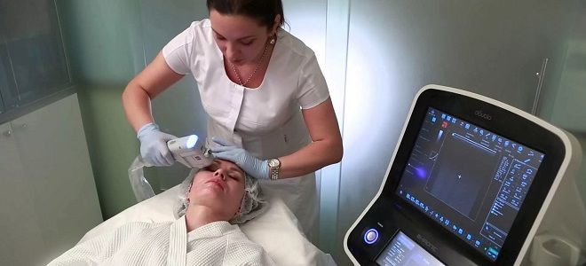 процедура смас лифтинг процедура смас лифтинг