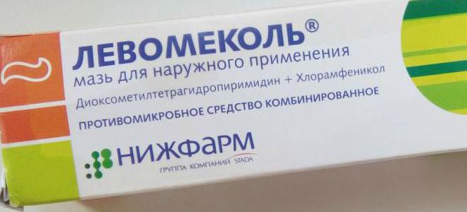 противовоспалительные мази противовоспалительные мази