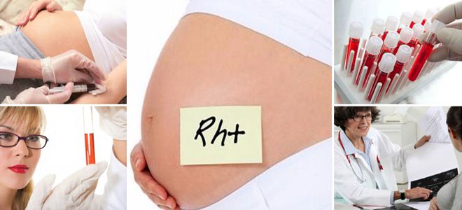 резус фактор при беременности резус фактор при беременности