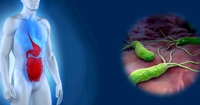 как лечить гастрит острый