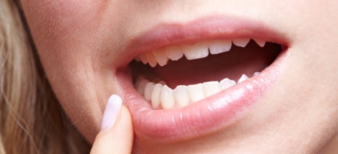 как убрать прыщ на губе