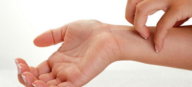 прыщи на руках