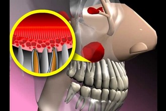 Так выглядят придаточные пазухи носа Придаточные пазухи
