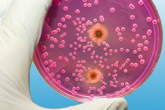 Классификация фарингомикоза бактерии