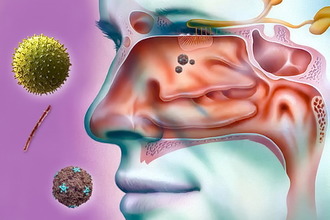 Воспалительный процесс в слизистых оболочках Воспалительный