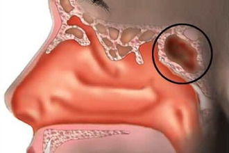 Клиновидная пазуха носа Схема
