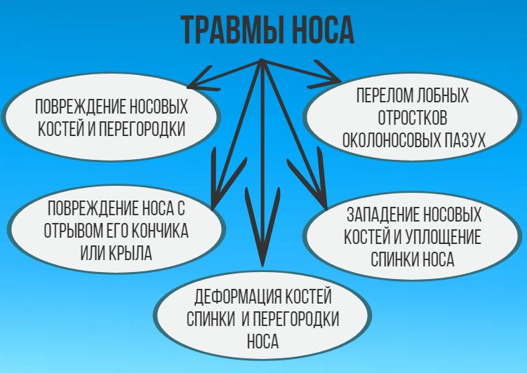 Какими бывают травмы носа? Травмы
