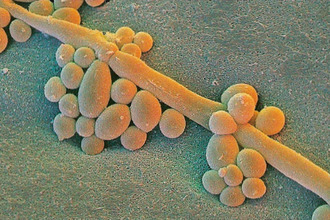 Грибковое заражение: род кандида Кандида