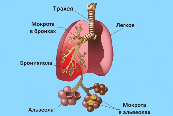 Причины трахейного кашля Действие