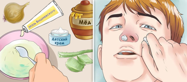 Рецепты приготовления мазей и закладка пропитанных тампонов в нос Рецепты