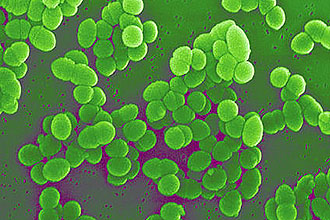 β-гемолитический стрептококк группы А Развитие бактериалного тонзиллита