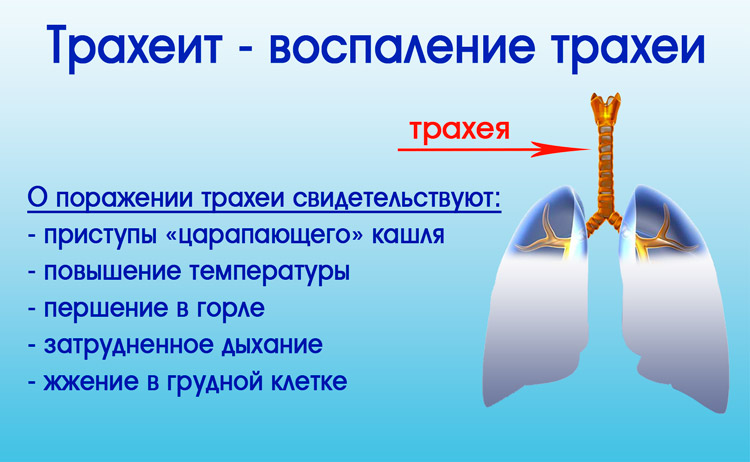 Механизм развития Трахея