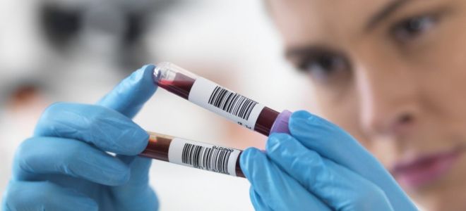 анализы на гормоны щитовидной железы анализы на гормоны щитовидной железы