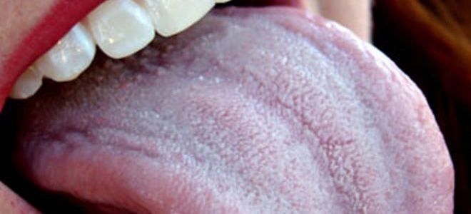 белый налет на языке норма белый налет на языке норма