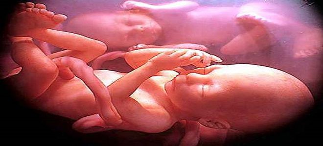 беременность двойней особенности беременность двойней особенности