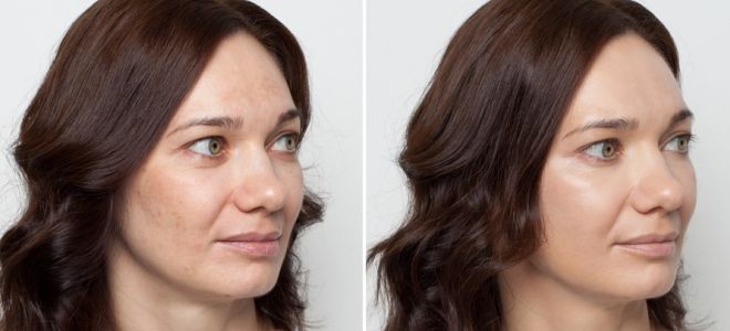 для чего нужен корректор для лица для чего нужен корректор для лица