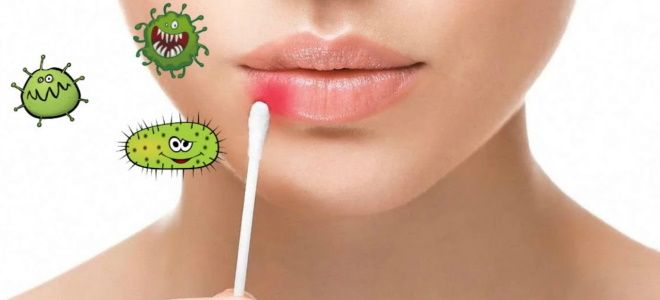 лечение герпеса во рту лечение герпеса во рту