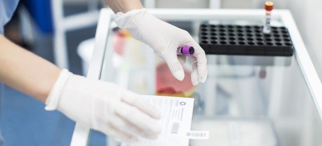 mpv в анализе mpv в анализе