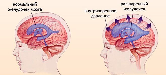 норма вчд норма вчд