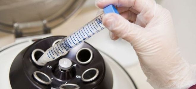 подвижность сперматозоидов норма подвижность сперматозоидов норма