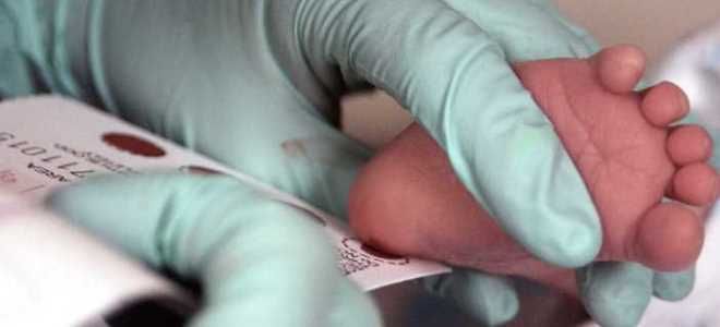 скрининг новорожденных скрининг новорожденных