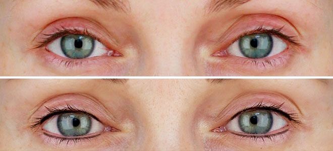 Татуаж заполнение межресничного пространства Татуаж заполнение межресничного пространства