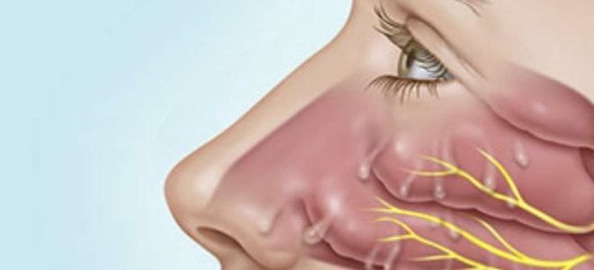 текут прозрачные сопли текут прозрачные сопли