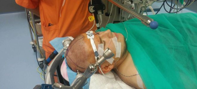 трепанация черепа что это трепанация черепа что это