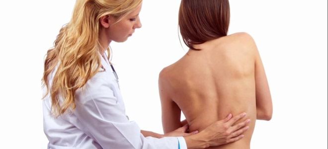 туберкулезный спондилит симптомы туберкулезный спондилит симптомы