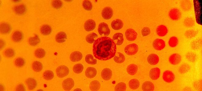 анализ мочи эритроциты анализ мочи эритроциты