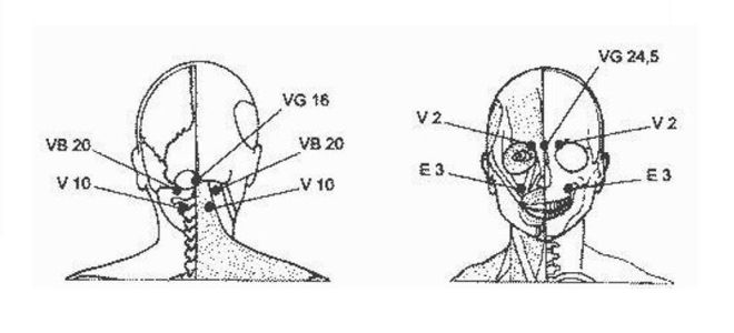 массаж при головной боли в области лба массаж при головной боли в области лба