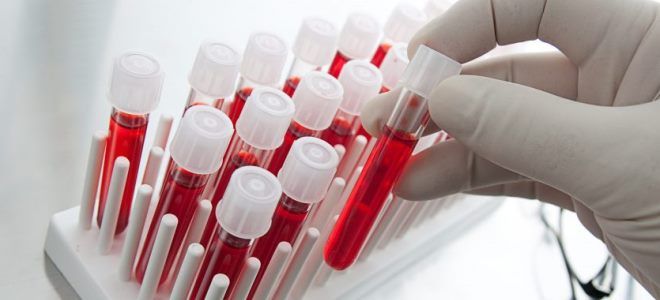 нужны ли антибиотики если нет температуры нужны ли антибиотики если нет температуры