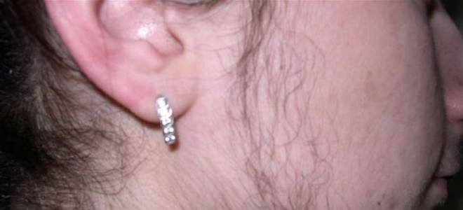 общий и свободный тестостерон общий и свободный тестостерон