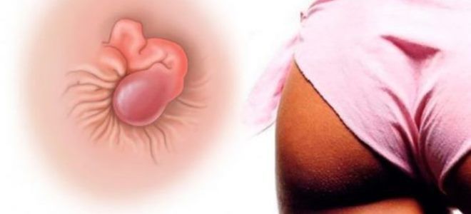 послеродовой геморрой послеродовой геморрой