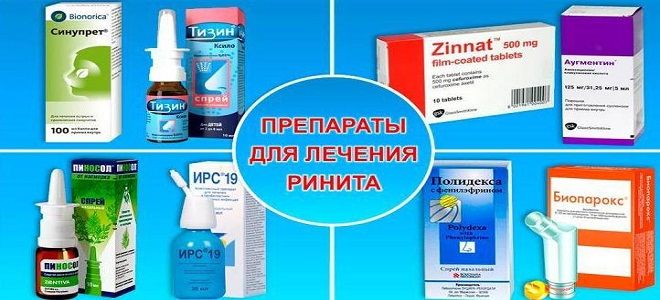 постоянная заложенность носа постоянная заложенность носа