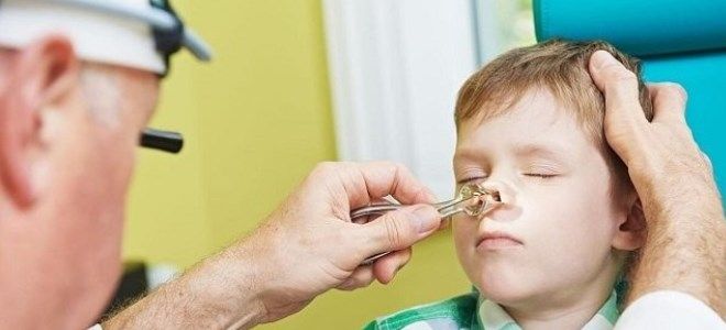 прозрачные сопли температура прозрачные сопли температура