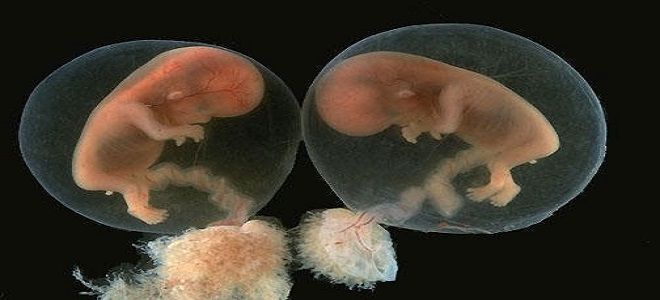 развитие многоплодной беременности развитие многоплодной беременности