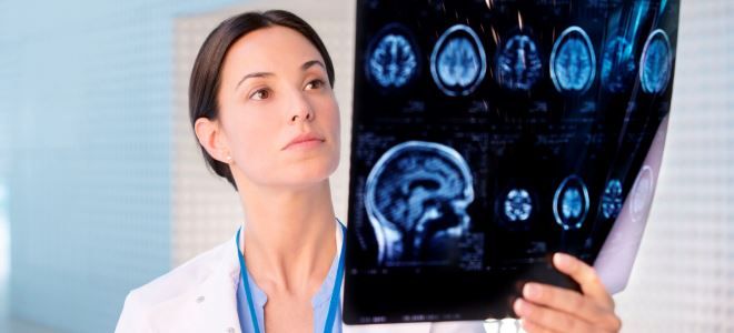 внутричерепная гипертензия внутричерепная гипертензия