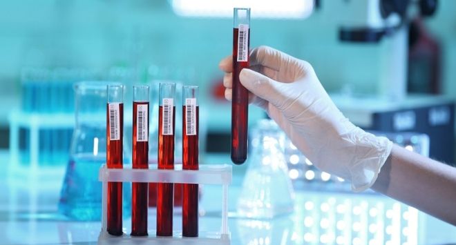 анализ на аллергию на кошек анализ на аллергию на кошек