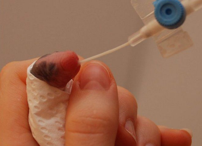 чем можно кормить маленькую крысу чем можно кормить маленькую крысу