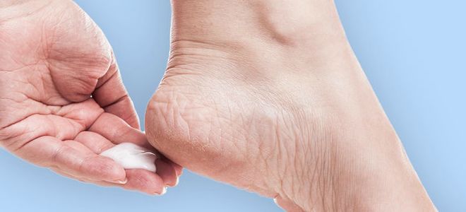 мазь для пяток от трещин мазь для пяток от трещин