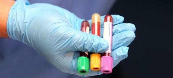 общий тестостерон у женщин общий тестостерон у женщин