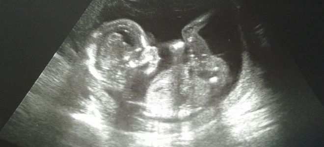 плод в 16 недель плод в 16 недель