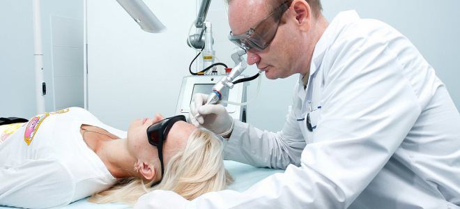 способы удаления папиллом способы удаления папиллом