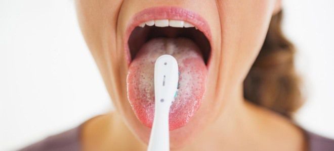 белый язык что делать белый язык что делать