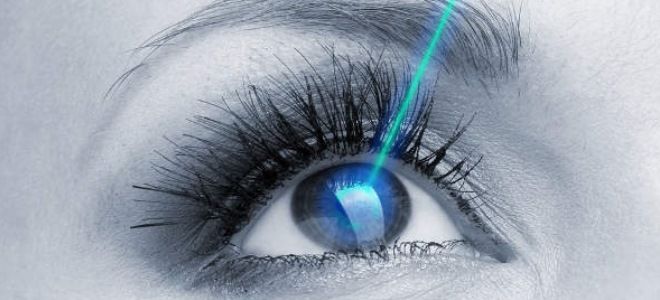 рефракционная лазерная хирургия рефракционная лазерная хирургия