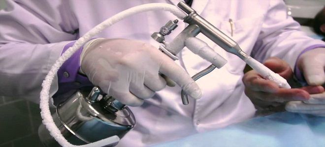 виды эрозии виды эрозии