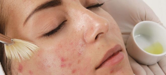 маска от постакне маска от постакне